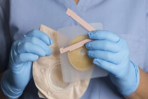 Stoma Care Management Training