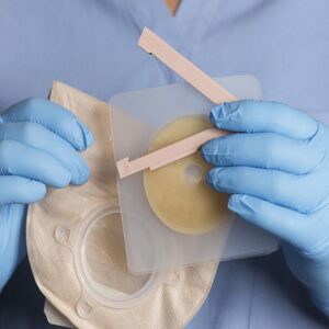 Stoma Care Management Training